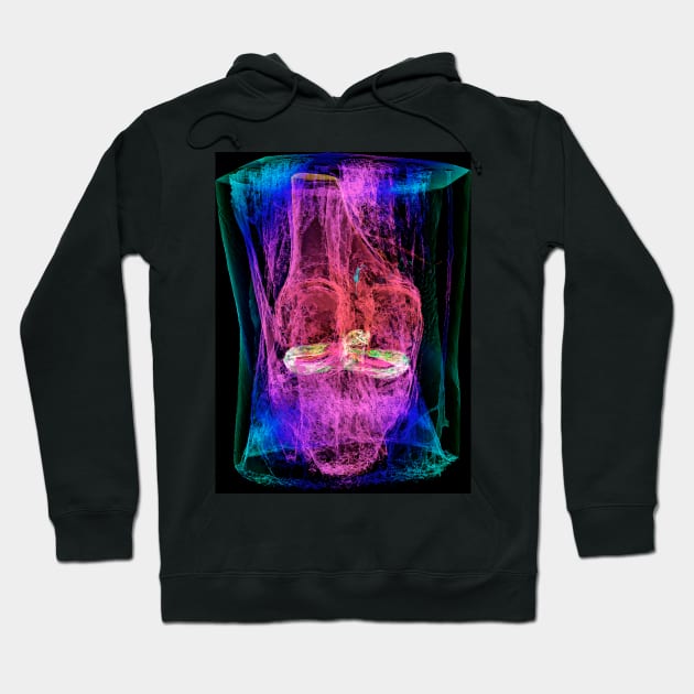 Knee menisci and ligaments, 3D MRI scan (C037/4594) Hoodie by SciencePhoto